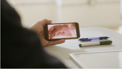 a picture of the inside of a man's mouth, viewed on a cellphone